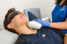 Depilación láser en Buenos Aires: equilibrio y textura de la piel